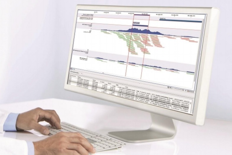 CLC-Bio Genomics Workbench